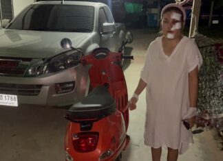 Pattaya Woman Injured in Hit-and-Run Accident
