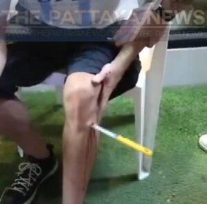 Thai Girlfriend Stabs Foreign Boyfriend in the Leg in Front of Shocked Tourists in Pattaya