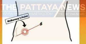 Medical Bytes Thailand Number 101: 82 Percent of Medical Diagnoses can be made on History Alone