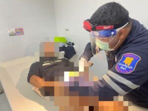 Pattaya Man Seeks Medical Help for Ring Stuck Around His Genitals