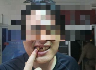 South Korean Tourist Loses Three Teeth After Getting Kicked in the Face by Pattaya Exotic Animal Exhibitor