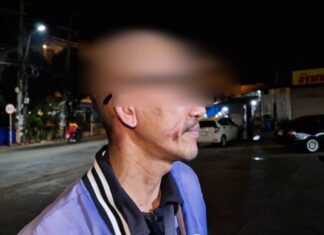 Motorbike Rider Injured After Communication Wire Gets Caught Around His Neck in Pattaya