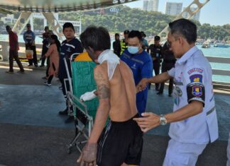 Severely Burned Cambodian Man Travels by Bus from Hua Hin to Pattaya to Seek Help from Thai Wife