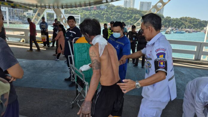 Серьезно обожженный камбоджиец едет автобусом из Хуа Хина в Паттайю в поисках помощи у тайской жены