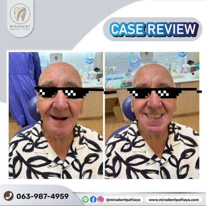 Как протезы могут изменить вашу жизнь с клиникой Miradent в Паттайе