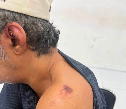 Kuwaitisk turist påstås ha blivit rånad på 20 000 baht på Pattaya Beach efter att ha ordnat sällskap över natten med misstänkt.